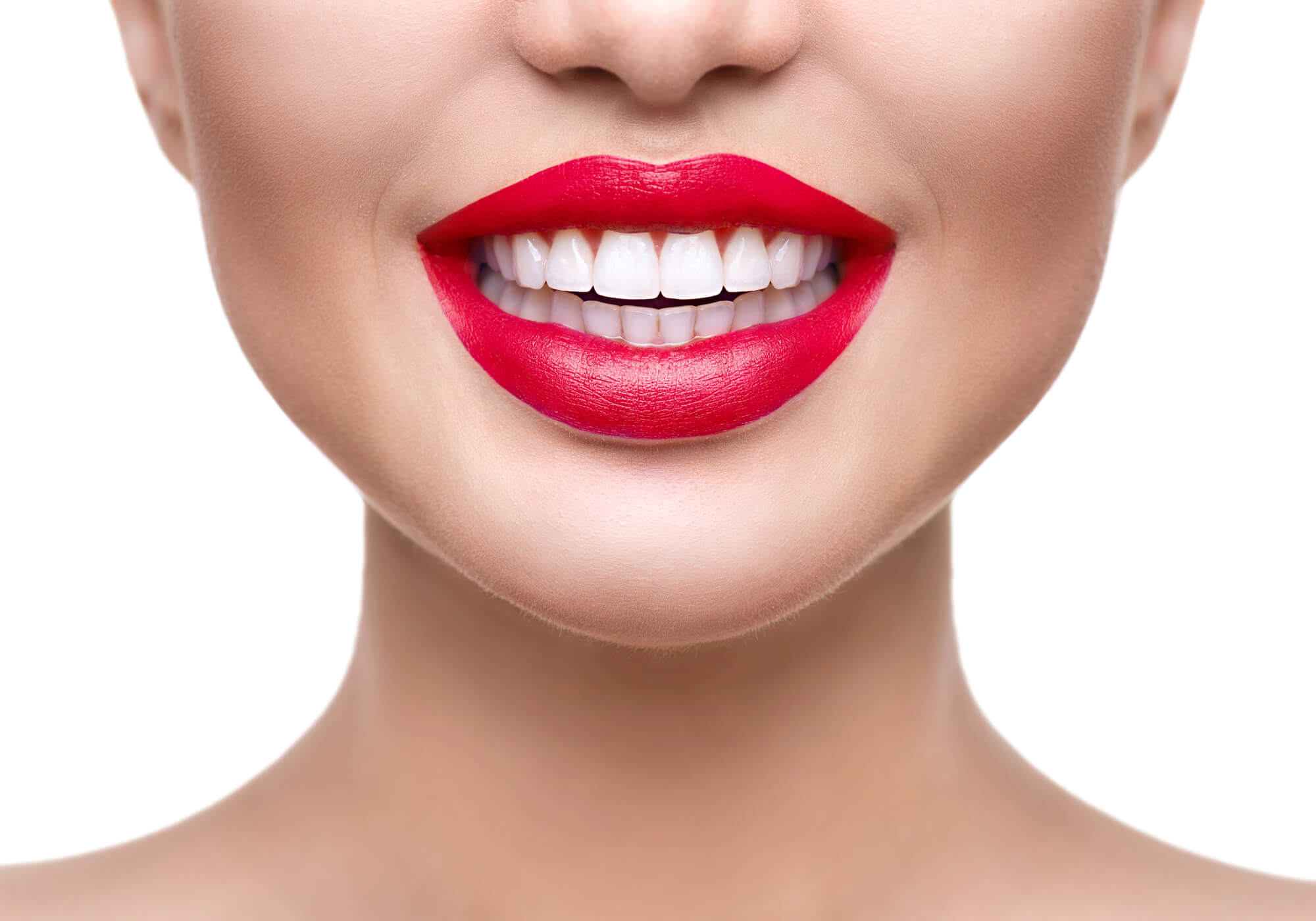 Everything You Need to Know About Professional Teeth Whitening 