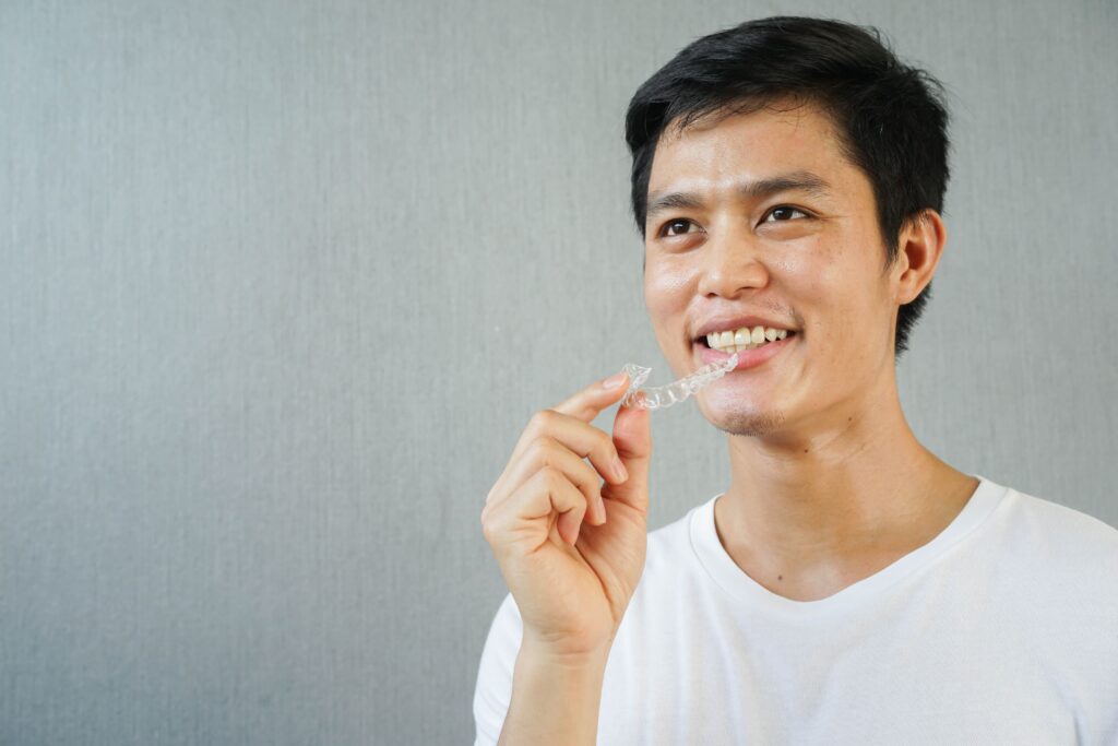 Clear Aligners