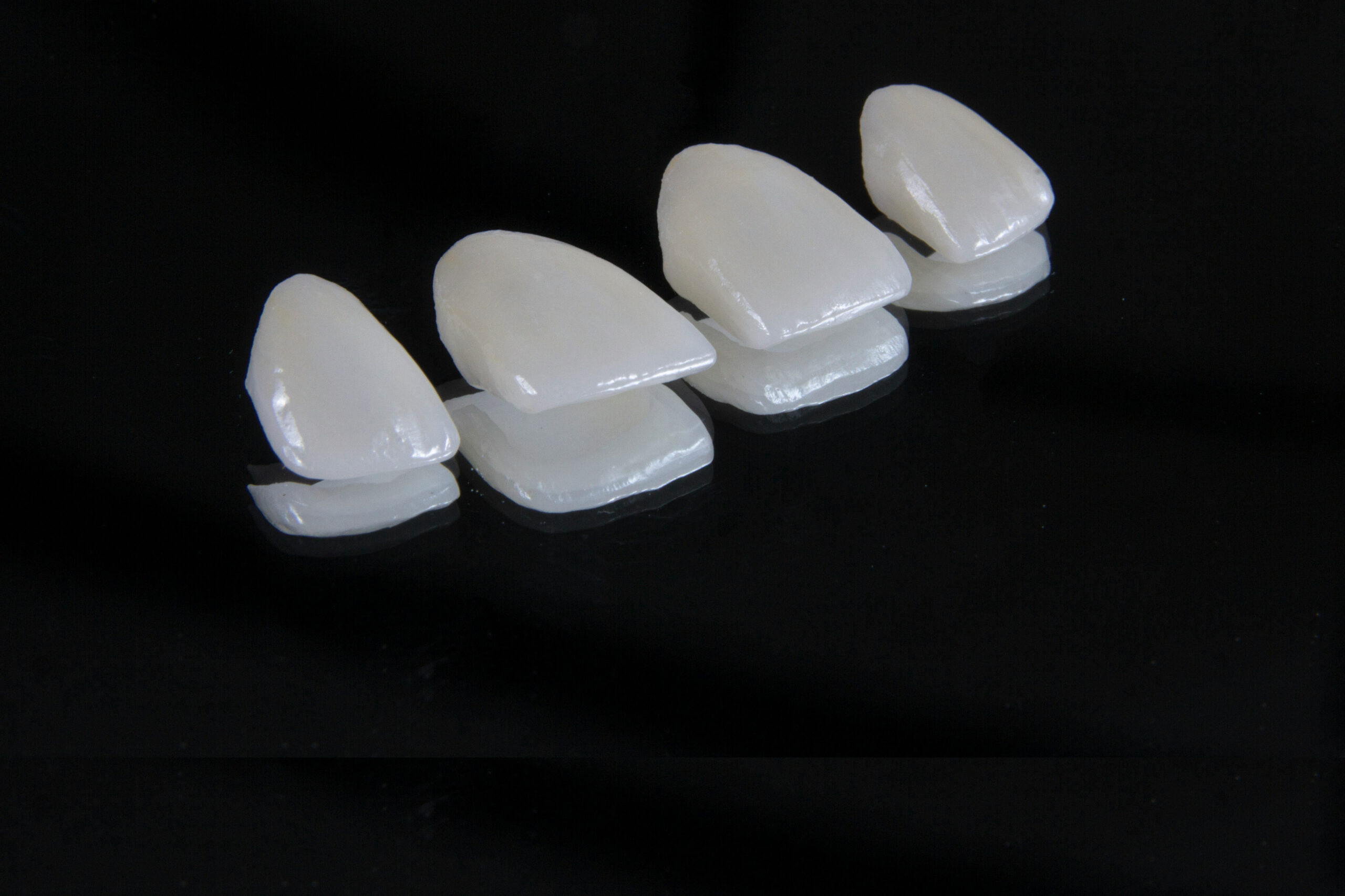 Dental Veneers in Denver