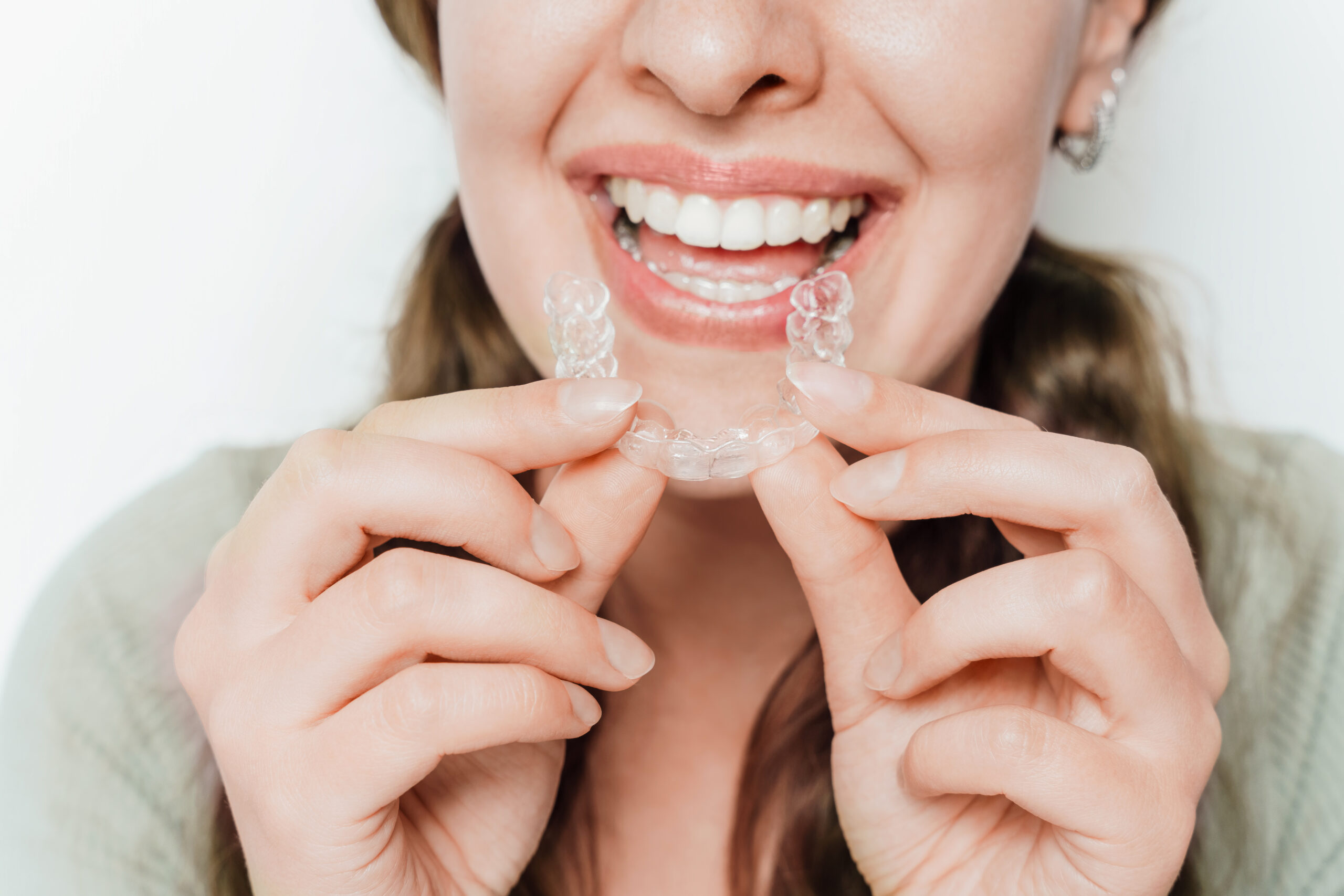 How Cutting-Edge Clear Aligner Technology Is Transforming Smiles in Denver: The Icon Dental Advantage
