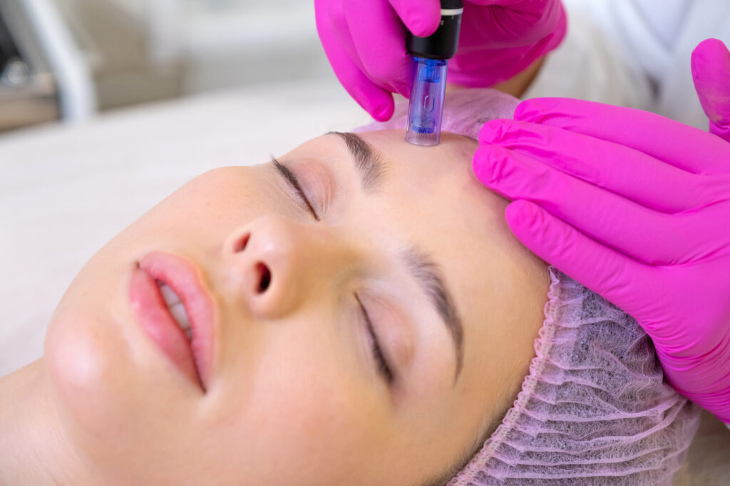 Beyond the Glow: The Definitive Guide to Denver Microneedling Safety, Science, and Long-Term Collagen Results